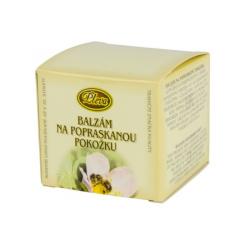 Balzam na popraskan� poko�ku